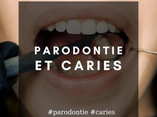 La parodontie et les lésions carieuses sont elles associées ?