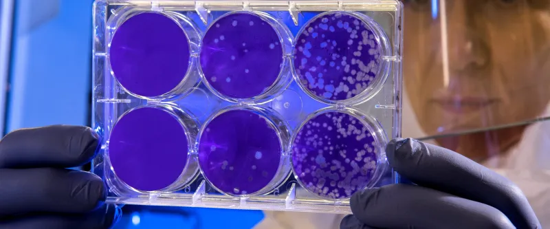 Covid-19 : Mise à jour scientifique